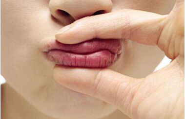 Ƽ|blistexС׹ܣרҵںٸɵĿںҲ